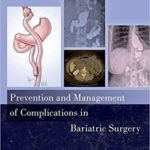 Prevention and management of complications in bariatric surgery