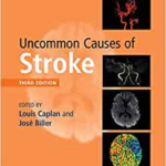 Uncommon causes of stroke