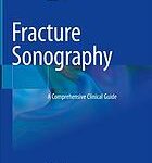 Fracture sonography